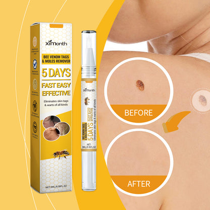 Ximonth Keyu Liquid Pen Clean Meat Granules Flat Especially Repair Skin Improve Skin Condition Fade Dark Spots
