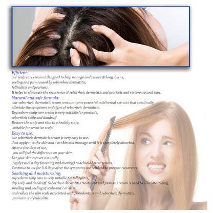 South Moon Skin Care Cream Gently Improve Scalp And Head Acne Skin Problems Care Cream