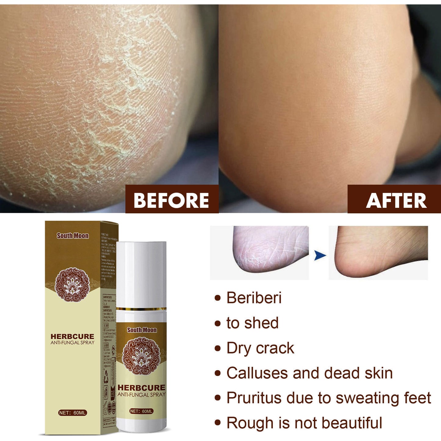 Herbal foot soothing spray