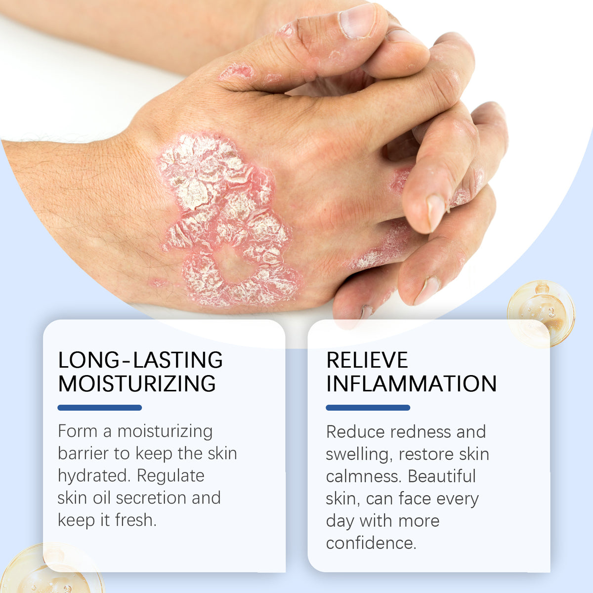 Bee Venom Skin Care Spray Moisturizes Skin And Restores Body Daily Care Topical Spray