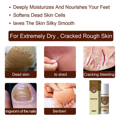 Herbal foot soothing spray