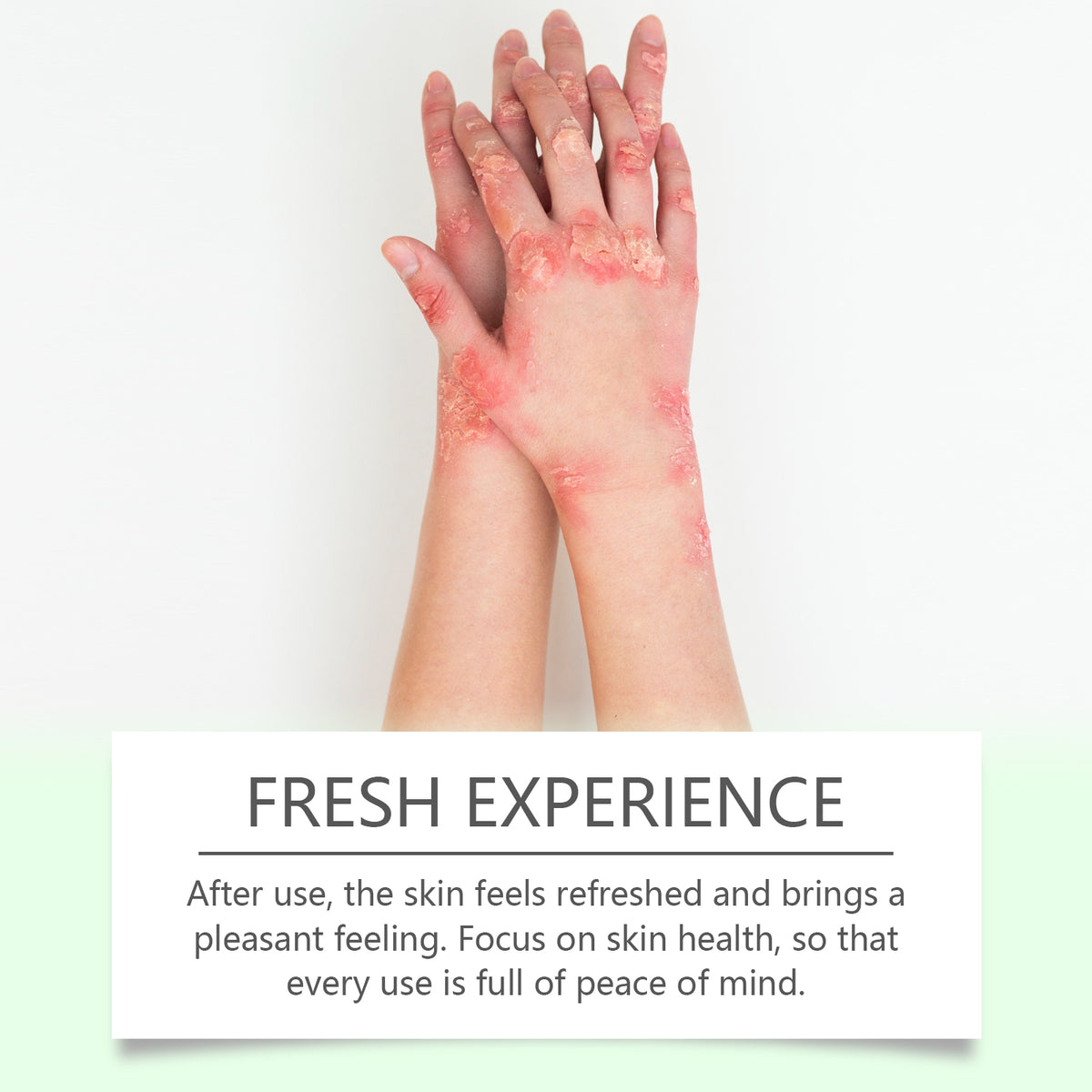 Herbal Skin Soothing Cream That Soothes And Nourishes Uncomfortable Skin With Body Skin Treatment Cream
