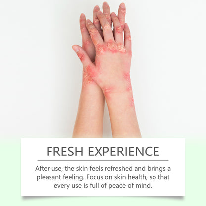 Herbal Skin Soothing Cream That Soothes And Nourishes Uncomfortable Skin With Body Skin Treatment Cream