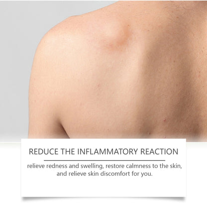 South Moon Body Care Drops Gently Remove Clumps And Repair The Back Of Legs To Restore Smooth Body