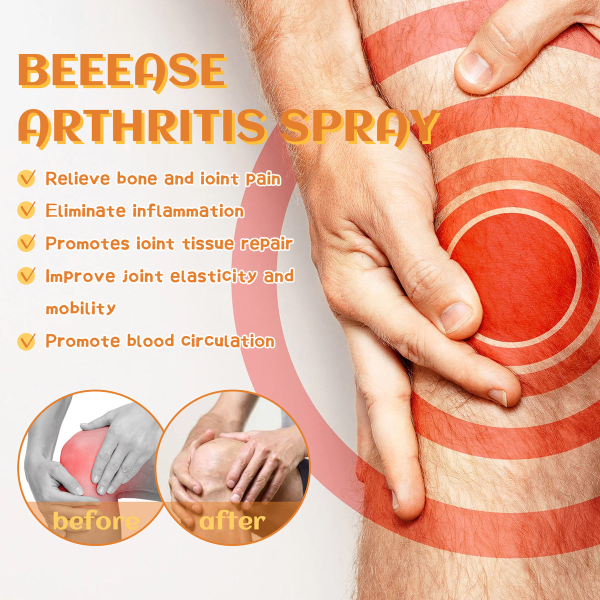South Moon Beease Arthritis Spray, Relieve Joint Pain Shoulder Cervical Vertebra Lumbar Body Care Spray