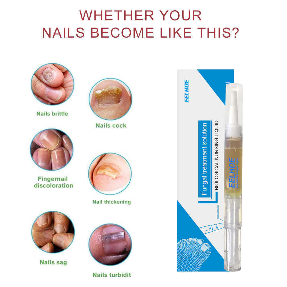 EELHOE Nail Care Solution Hand, Foot And Nail Care Clean Soft Nails Daily Gentle Moisturizing And Curing Polish Solution