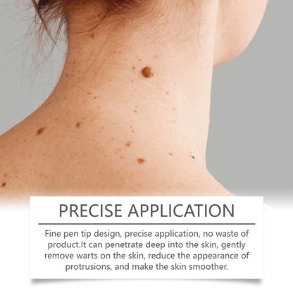 Ximonth Keyu Liquid Pen Clean Meat Granules Flat Especially Repair Skin Improve Skin Condition Fade Dark Spots